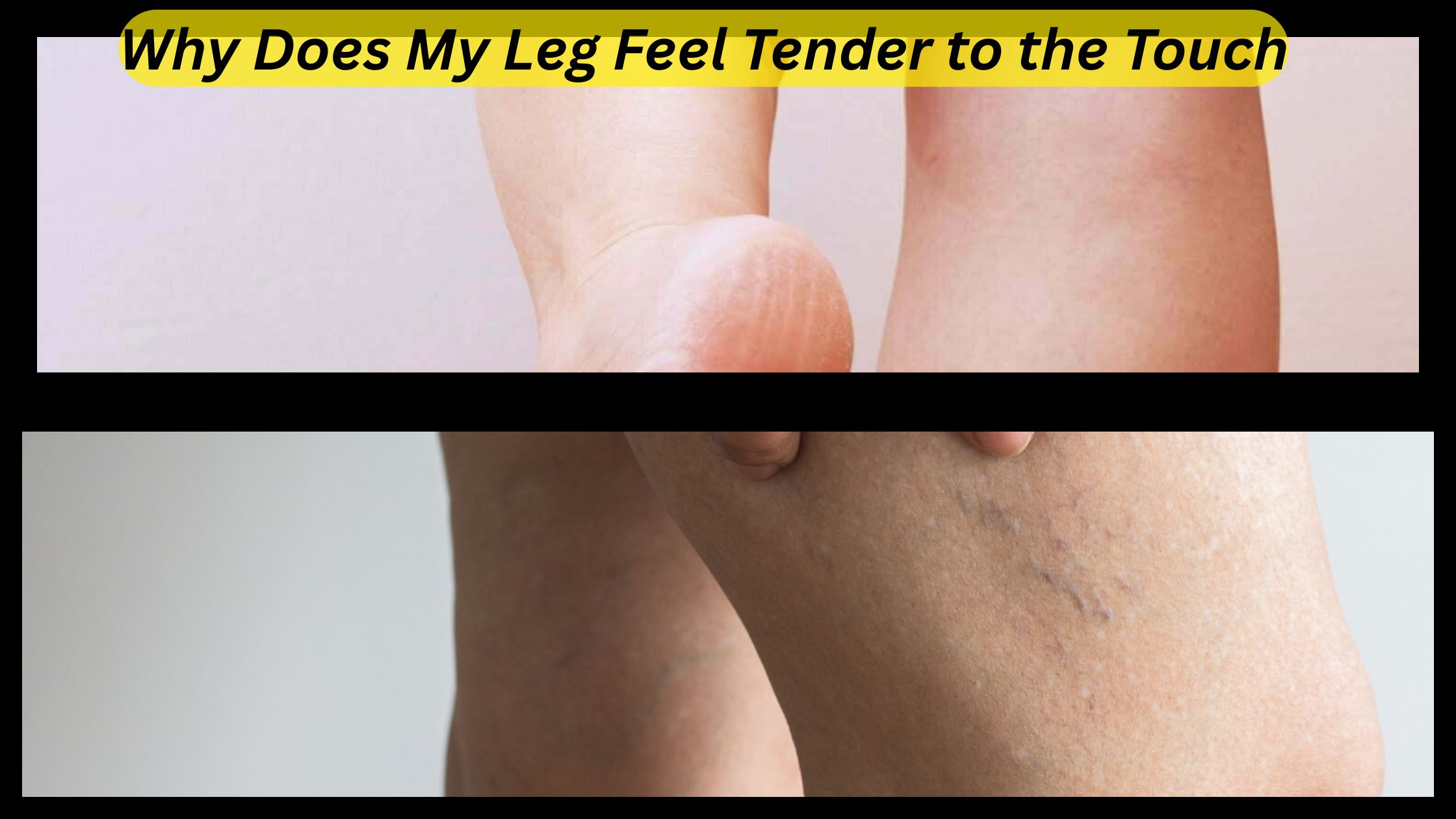 Why Does My Leg Feel Tender to the Touch? – Elite Vascular