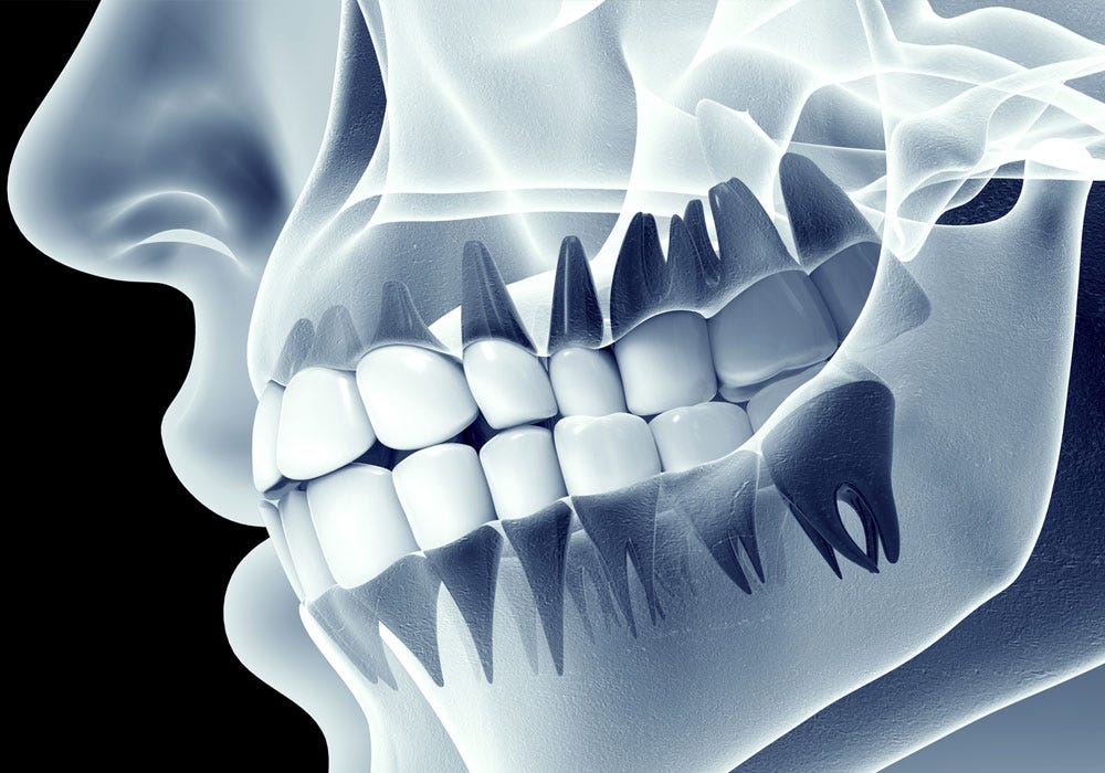 Dental X Ray Centres in RR Nagar. Accurate diagnosis is the foundation of… | by Symphonysmiles | Jun, 2025 | Medium