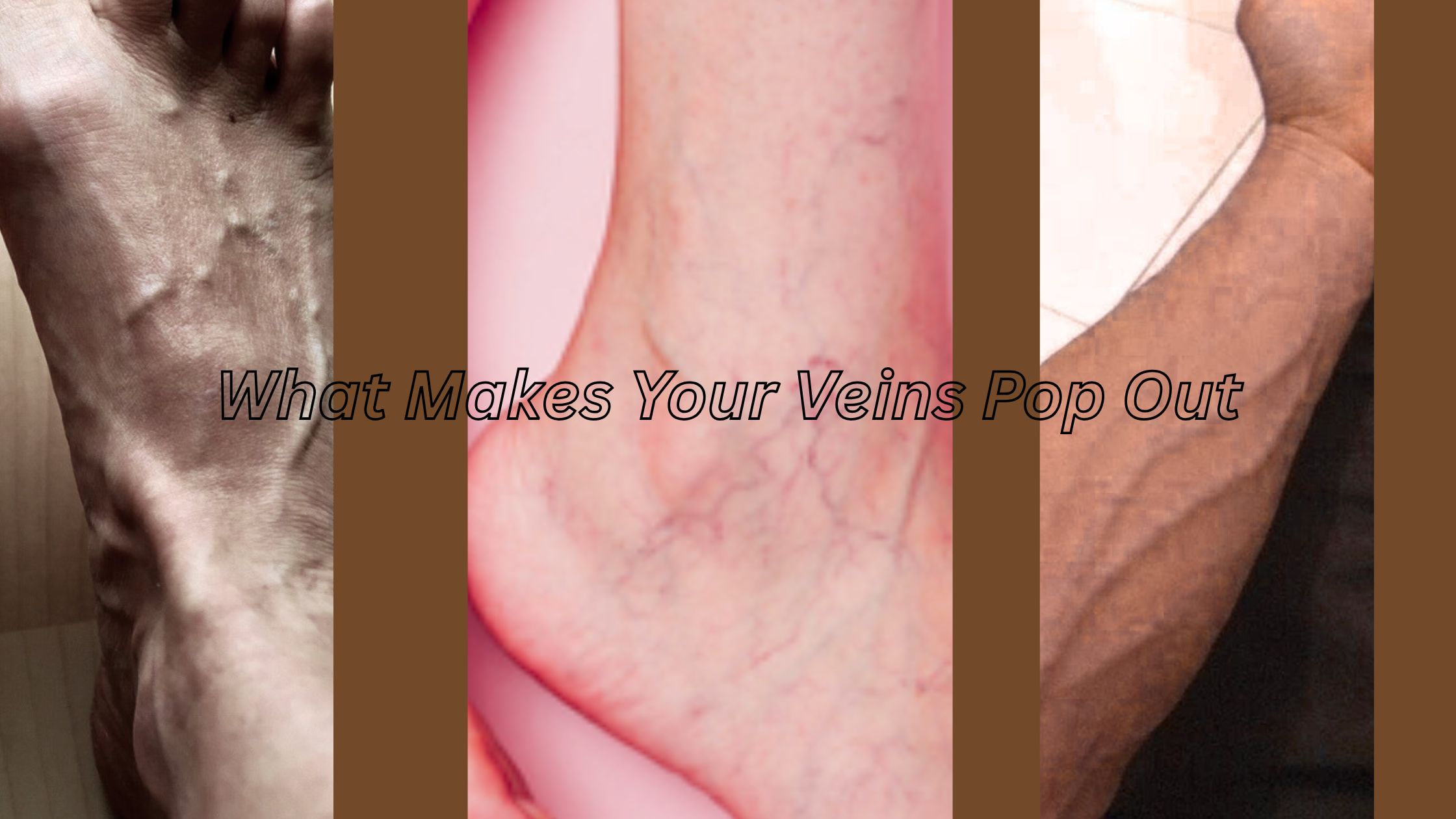 What Makes Your Veins Pop Out: Understanding Visible Veins – Elite Vascular