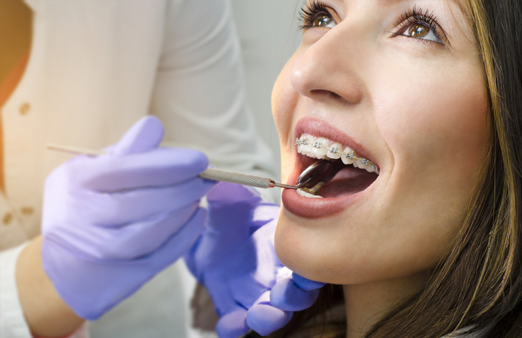 Different Types of Teeth Braces for Every Need - Dr. Anirudh Agarwal