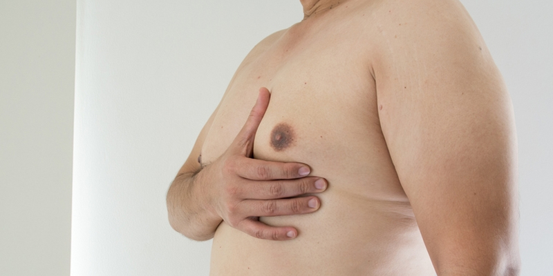 Reduce Gynecomastia Naturally at Home
