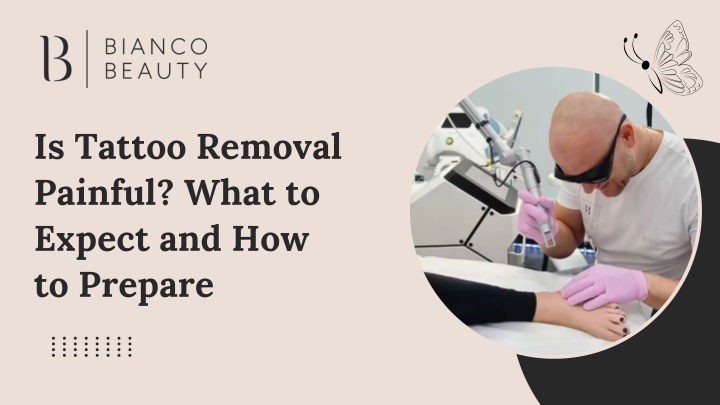 PPT - Is Tattoo Removal Painful? What to Expect and How to Prepare PowerPoint Presentation - ID:14364915