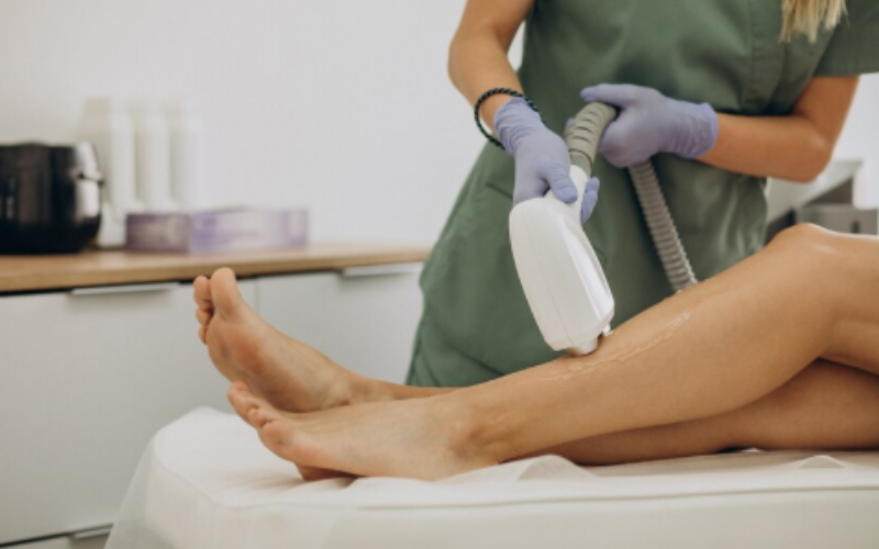 Smooth Results with Laser Hair Removal in Bankstown