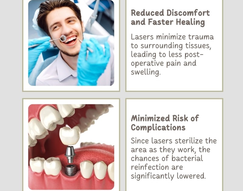The Future of Root Canal Therapy Laser Assisted Treatment