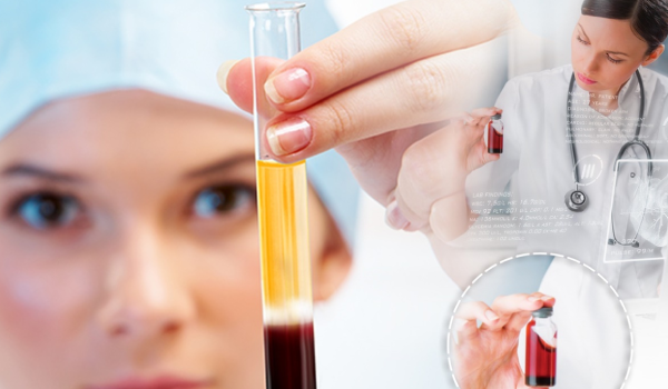 PRP Injections for Joint Pain & Sports Injuries