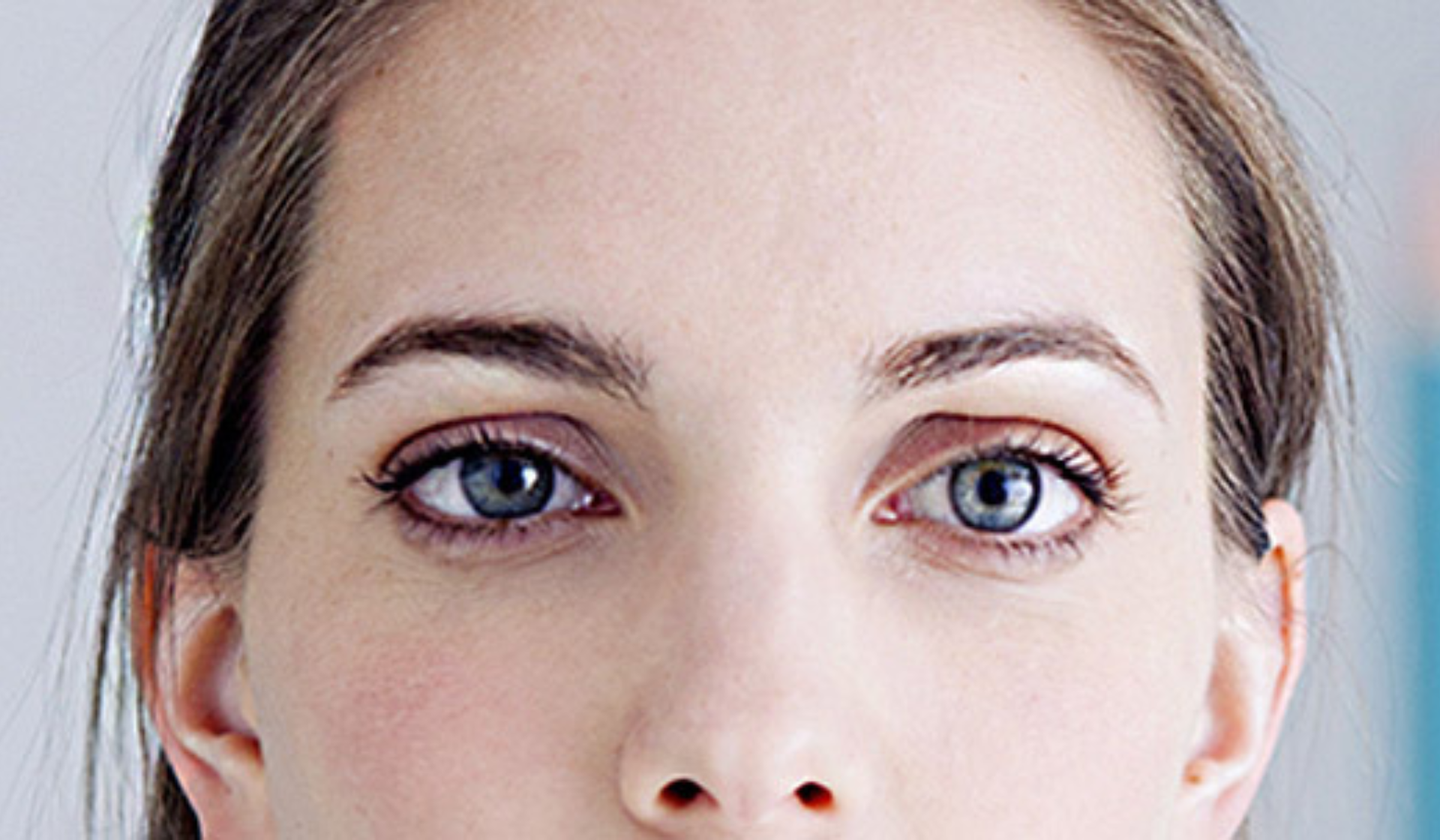 Squint Eye Treatment in Raipur