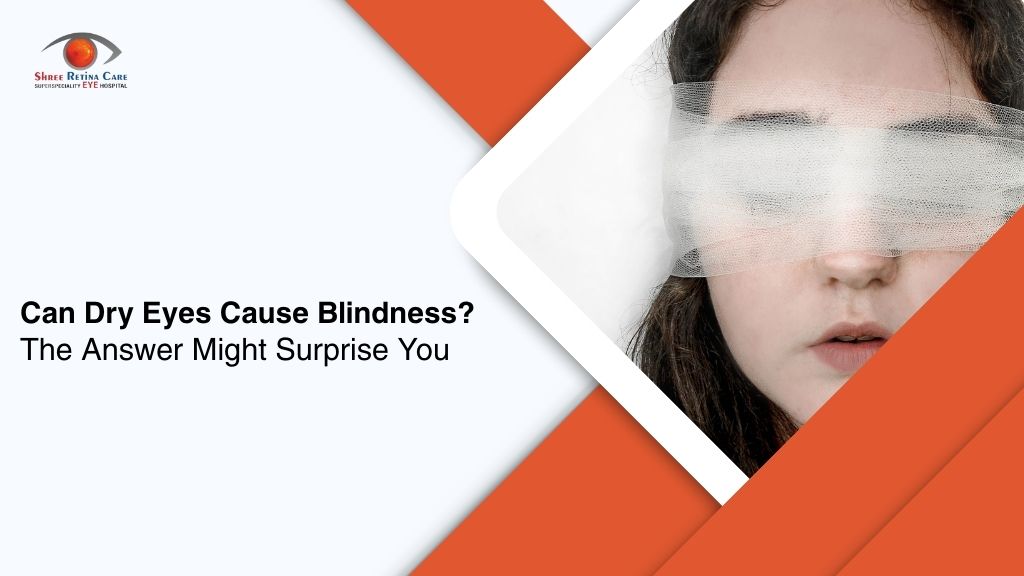 Can Dry Eyes Cause Blindness? Know the Facts