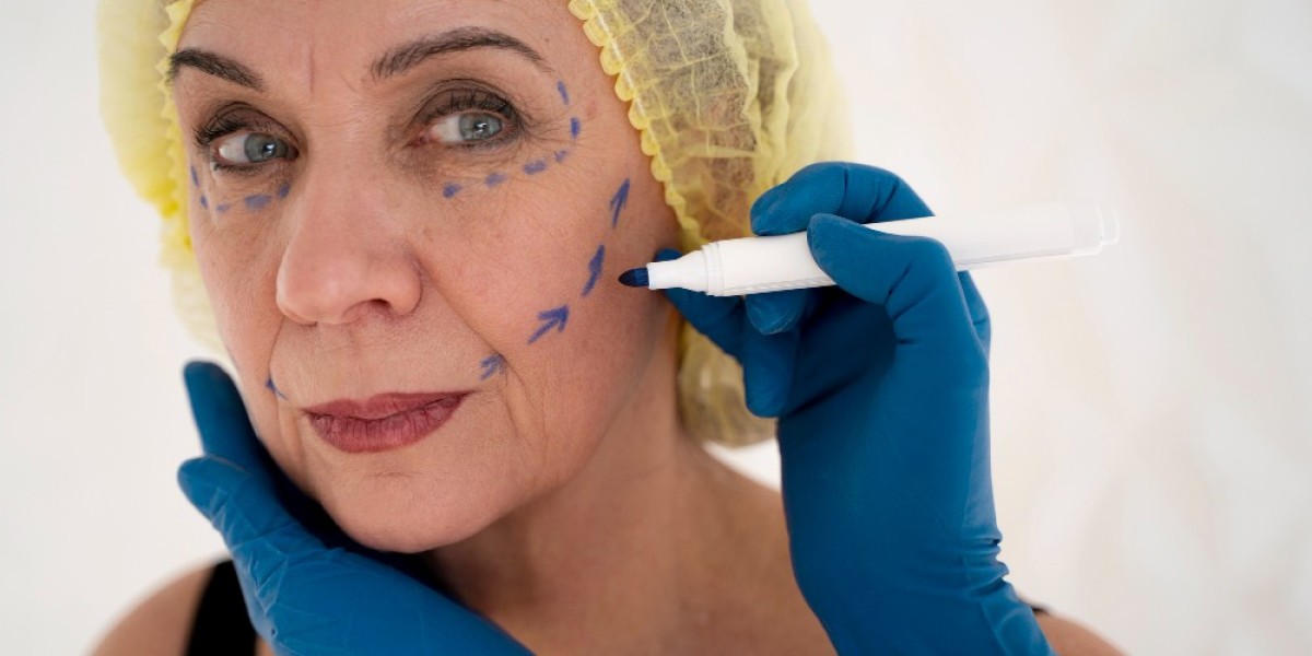 Non Surgical Facelift Options in San Ramon, USA