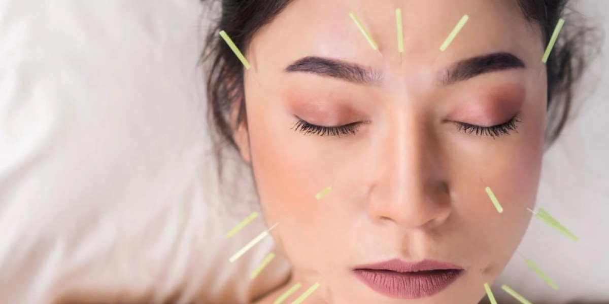 Facial Acupuncture NYC
