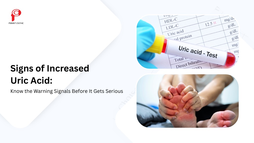 Signs of Increased Uric Acid: Know the Warning Signals Before It Gets Serious - Pushp Clinic
