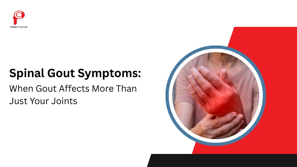 Spinal Gout Symptoms: When Gout Affects More Than Just Your Joints - Pushp Clinic