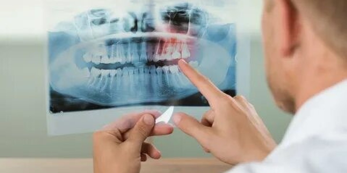 The Growing Role of Dental Radiology in Sharjah — Spotlight on Alkhair Dental