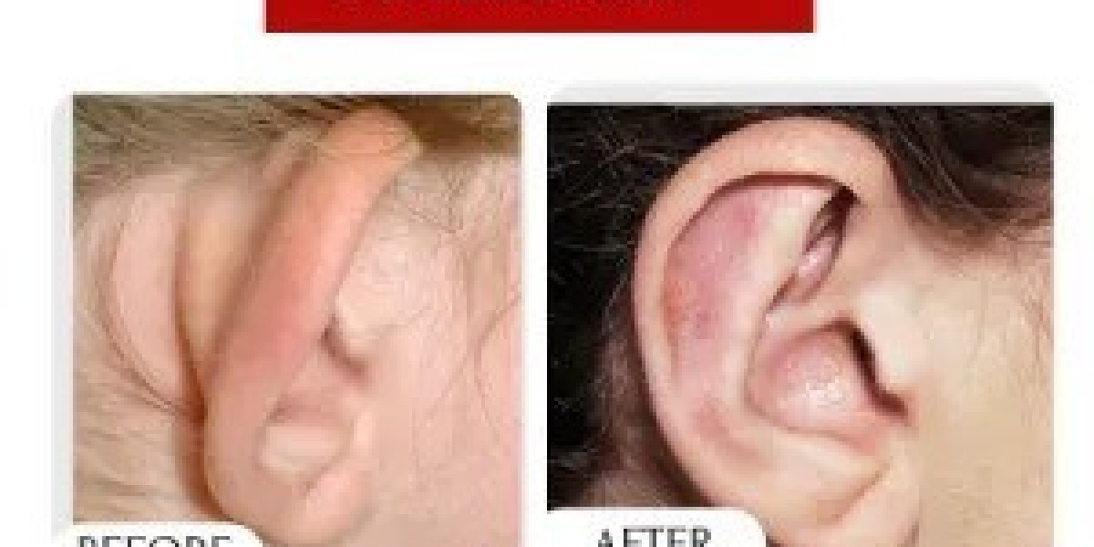 Article Picture