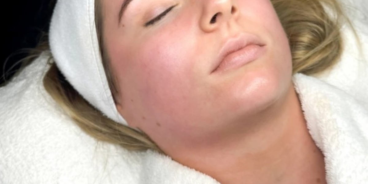 Biorepeel In Manchester for Radiant Skin Renewal