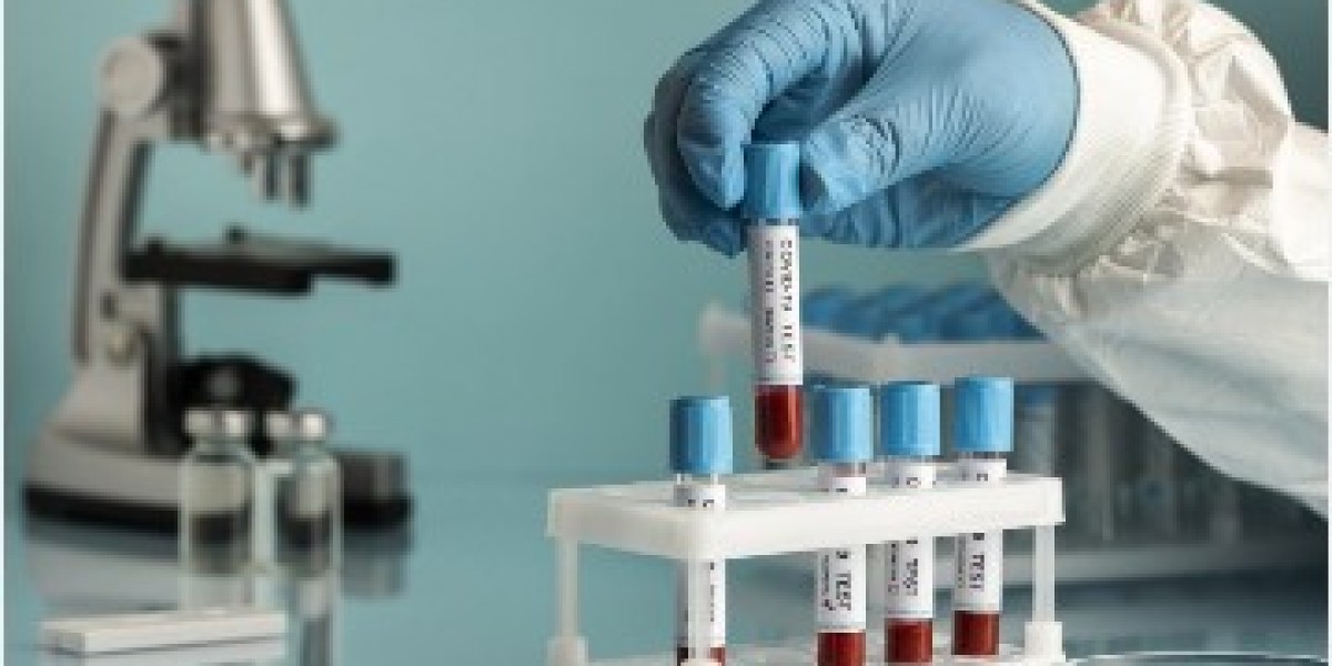 LFT Test Price in Lahore – Complete Guide to Liver Function Test, Benefits, Procedure & Cost Factors (2026)
