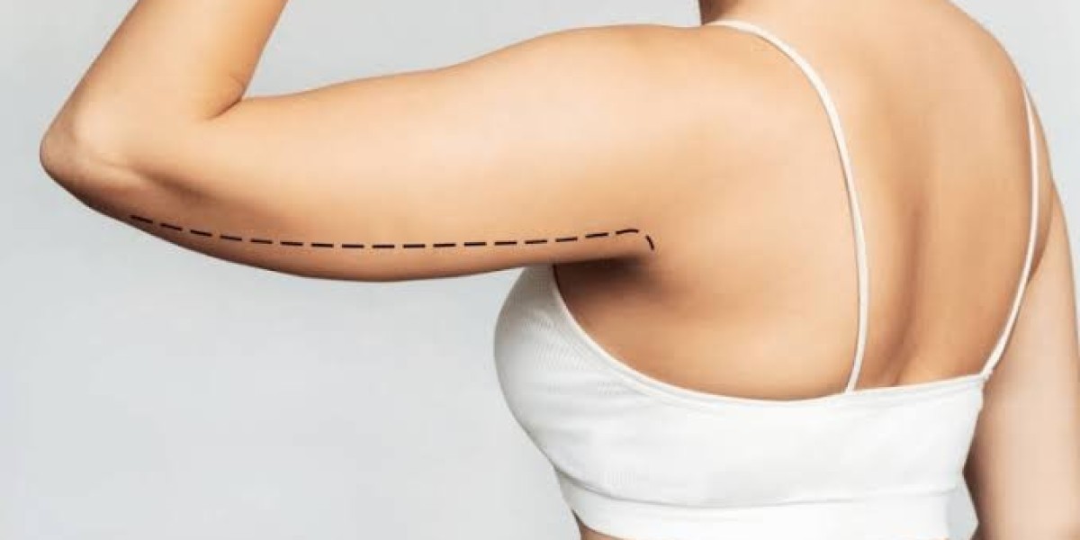 Arm Lift in Dubai: A Complete Guide to Achieving Toned and Contoured Arms