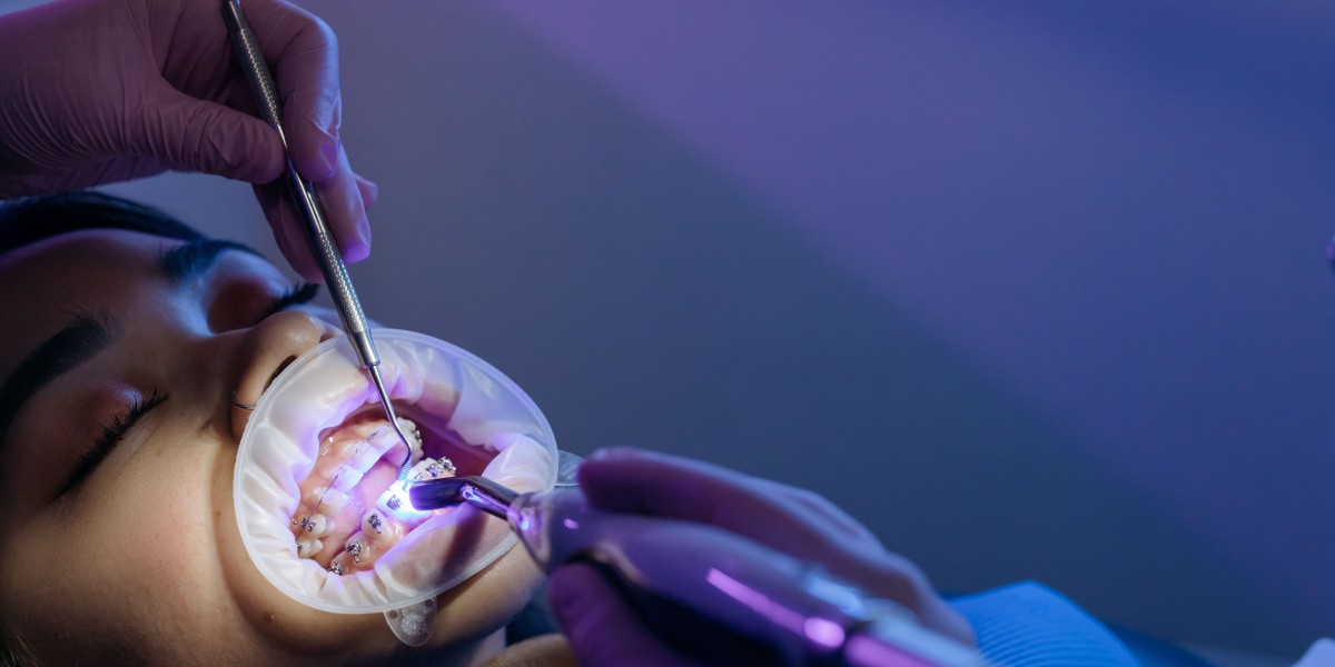 Modern Teeth Alignment Solutions for Everyday Comfort and Confidence